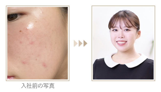 スタッフ写真ビフォーアフター